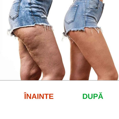 Costum de slăbit pentru TALIE și COAPSE "Bye Bye Kilos"