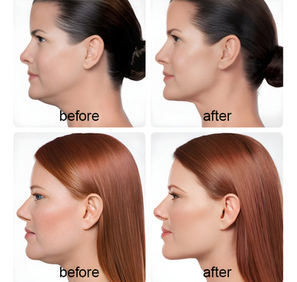 Dispozitiv pentru eliminarea gusei Sbelt Neck Slimmer